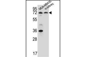 P2RX7 Antibody (C-term) (ABIN651861 and ABIN2840427) western blot analysis in MDA-M cell line and mouse kidney tissue lysates (15 μg/lane). (P2RX7 Antikörper  (AA 563-592))