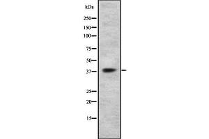 Western blot analysis GPR105 using HT29 whole cell lysates (P2RY14 Antikörper  (Internal Region))