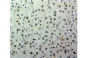 IHC-P analysis of Liver tissue, with DAB staining. (HNF1B Antikörper  (AA 159-300))