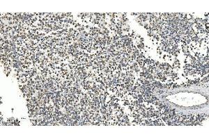 IHC analysis of NOX2/gp91phox/CYBB using anti-NOX2/gp91phox/CYBB antibody (ABIN7599875). (CYBB Antikörper  (AA 124-559))
