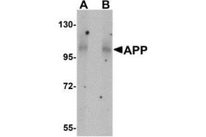 Western blot analysis of APP in mouse brain tissue lysate with AP30072PU-N APP antibody at (A) 1 and (B) 2 μg/ml.