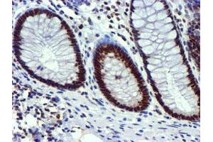 Image no. 3 for anti-Ubiquitin Specific Peptidase 7 (Herpes Virus-Associated) (USP7) antibody (ABIN1498592) (USP7 Antikörper)