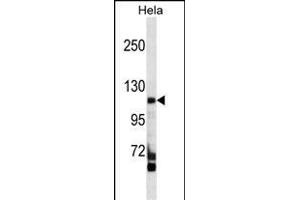FC Antibody (C-term) (ABIN1537556 and ABIN2849534) western blot analysis in Hela cell line lysates (35 μg/lane). (FAM65C Antikörper  (C-Term))