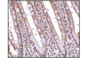 Immunohistochemistry of PHAP in human small intestine tissue with this product at 10 μg/ml.