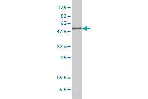 KPNA1 monoclonal antibody (M01), clone 2A4-1B5 Western Blot analysis of KPNA1 expression in HeLa . (KPNA1 Antikörper  (AA 1-538))