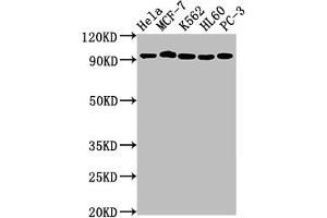 Western Blot Positive WB detected in: Hela whole cell lysate, MCF-7 whole cell lysate, K562 whole cell lysate, HL60 whole cell lysate, PC-3 whole cell lysate All lanes: TOP1 antibody at 1:2000 Secondary Goat polyclonal to rabbit IgG at 1/50000 dilution Predicted band size: 91 kDa Observed band size: 91 kDa (Rekombinanter Topoisomerase I Antikörper)