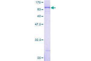 IGF2BP3 Protein (AA 1-579) (GST tag)