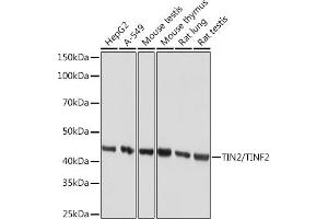 Western blot analysis of extracts of various cell lines, using TIN2/TINF2 Rabbit mAb (ABIN7270771) at 1:1000 dilution. (TINF2 Antikörper)