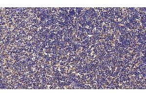 Immunohistochemistry (IHC) image for anti-Baculoviral IAP Repeat-Containing 5 (BIRC5) (AA 1-142) antibody (ABIN7426451)