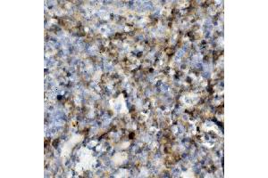 IHC analysis of SELPLG using anti-SELPLG antibody (ABIN7600337).