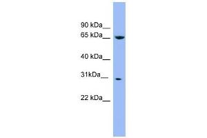 NDUFS3 antibody used at 1 ug/ml to detect target protein.