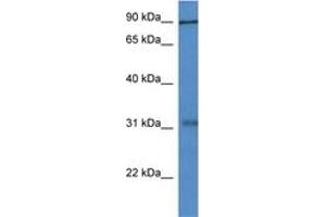 Image no. 1 for anti-Midline 2 (MID2) (AA 210-259) antibody (ABIN6746086) (Midline 2 Antikörper  (AA 210-259))