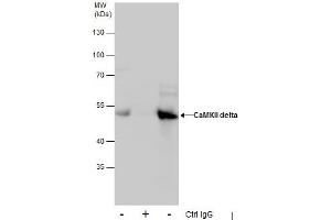 IP Image Immunoprecipitation of CaMKII delta protein from HepG2 whole cell extracts using 5 μg of CaMKII delta antibody, Western blot analysis was performed using CaMKII delta antibody, EasyBlot anti-Rabbit IgG  was used as a secondary reagent. (CAMK2D Antikörper)