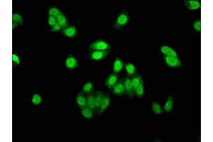 Immunofluorescence staining of HepG2 cells with ABIN7144468 at 1:530, counter-stained with DAPI. (AEN Antikörper  (AA 117-325))