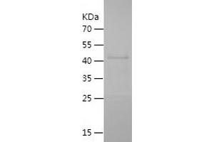 Western Blotting (WB) image for Zona Pellucida Glycoprotein 3 (ZP3) (AA 183-386) protein (His-IF2DI Tag) (ABIN7125817)