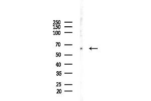 Western blot analysis of lysates from HepG2 cells(LPS,4h treatment), using STIP1 Antibody at 1/1000 dilution.