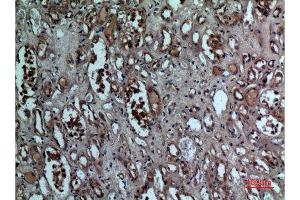 Immunohistochemistry (IHC) analysis of paraffin-embedded Human Kidney, antibody was diluted at 1:100. (BNIP3 Antikörper  (Internal Region))