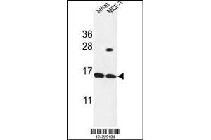 Western blot analysis in Jurkat,MCF-7 cell line lysates (35ug/lane). (SPRR1A Antikörper  (C-Term))