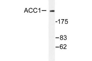 Image no. 1 for anti-Acetyl-CoA Carboxylase alpha (ACACA) antibody (ABIN271865) (Acetyl-CoA Carboxylase alpha Antikörper)
