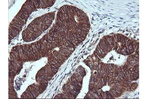 Immunohistochemistry (IHC) image for anti-Acetyl-CoA Acyltransferase 2 (ACAA2) antibody (ABIN1495727) (ACAA2 Antikörper)