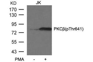 Western blot analysis of extracts from JK cells untreated or treated with PMA using PKCβ (phospho-Thr641) antibody.