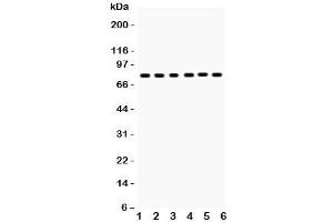 Western blot testing of tPA antibody and Lane 1:  mouse lung;  2: (m) testis; and human samples  3: U87;  4: A431;  5: A375;  6: A549 lysate (PLAT Antikörper  (AA 366-562))