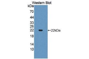Western Blotting (WB) image for anti-Slit Homolog 3 (SLIT3) antibody (Biotin) (ABIN1176109) (SLIT3 Antikörper  (Biotin))