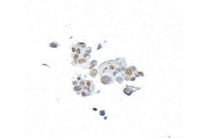 anti-BRCA1 Associated Protein-1 (Ubiquitin Carboxy-terminal Hydrolase) (BAP1) (AA 475-525) antibody