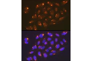 Immunofluorescence analysis of U-2 OS cells using TGN46/TGOLN2 Rabbit mAb (ABIN7270875) at dilution of 1:100 (40x lens). (TGOLN2 Antikörper)