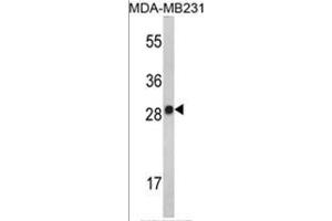 Western blot analysis of AP17501PU-N IL2 Antibody (Center) in MDA-MB231 cell line lysates (35 µg/lane). (IL-2 Antikörper  (AA 57-86))