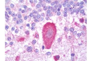 Immunohistochemistry (IHC) image for anti-Inositol 1,4,5-Trisphosphate Receptor, Type 3 (ITPR3) (AA 625-675) antibody (ABIN2624376)