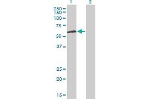 Western Blot analysis of CCT8 expression in transfected 293T cell line by CCT8 MaxPab polyclonal antibody. (CCT8 Antikörper  (AA 1-548))