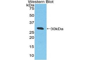 Western Blotting (WB) image for anti-DEAD (Asp-Glu-Ala-Asp) Box Polypeptide 58 (DDX58) (AA 550-776) antibody (ABIN1860445)