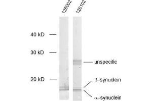 dilution: 1 : 1000, sample: crude synaptosomal fraction of rat brain (P2) (Alpha, beta Synuclein (AA 2-25), (N-Term) Antikörper)