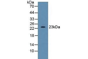 Detection of SDF2 in Human HepG2 Cells using Polyclonal Antibody to Stromal Cell Derived Factor 2 (SDF2) (SDF2 Antikörper  (AA 19-211))