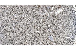 IHC analysis of HP1 alpha/CBX5 using anti-HP1 alpha/CBX5 antibody (ABIN7599057). (CBX5 Antikörper  (AA 1-191))