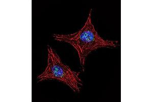 Confocal immunofluorescent analysis of UTY Antibody (C-term) (ABIN653016 and ABIN2842639) with MDA-M cell followed by Alexa Fluor 488-conjugated goat anti-rabbit lgG (green). (UTY Antikörper  (C-Term))