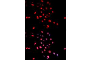 Immunofluorescence analysis of MCF7 cell using Phospho-c-Jun-S63 antibody.