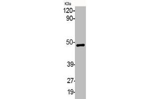 Western Blot analysis of various cells using Phospho-MEK-1/2 (S218/222) Polyclonal Antibody (MEK1 Antikörper  (pSer218, pSer222))