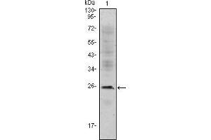 Western blot analysis using CD3E mouse mAb against Jurkat (1) cell lysate. (CD3 epsilon Antikörper)