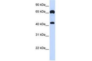 Image no. 1 for anti-Guanylate Cyclase 1, Soluble, beta 3 (GUCY1B3) (AA 180-229) antibody (ABIN6740948) (GUCY1B3 Antikörper  (AA 180-229))