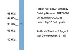 WB Suggested Anti-STK31  Antibody Titration: 0. (STK31 Antikörper  (N-Term))