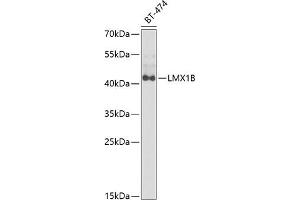 Western blot analysis of extracts of BT-474 cells, using LMX1B antibody  at 1:1000 dilution. (LMX1B Antikörper  (AA 136-395))