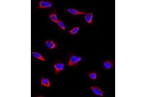 Immunofluorescence analysis of SOX9 polyclonal antibody  in HeLa cells. (SOX9 Antikörper  (N-Term))