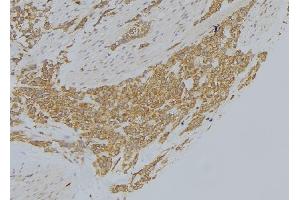 ABIN6273008 at 1/100 staining Human lung tissue by IHC-P. (MICAL1 Antikörper  (Internal Region))