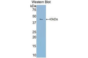 Western blot analysis of the recombinant protein. (Transferrin Antikörper  (AA 360-682))