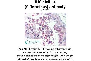 Image no. 2 for anti-Histone-Lysine N-Methyltransferase MLL4 (MLL4) (C-Term) antibody (ABIN1736980) (MLL4 Antikörper  (C-Term))