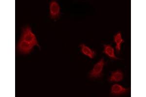 ABIN6275628 staining Hela by IF/ICC. (THAP4 Antikörper  (Internal Region))