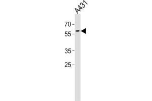 Western Blotting (WB) image for anti-Paired Box 3 (PAX3) antibody (ABIN3001734) (Paired Box 3 Antikörper)