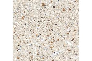 anti-RNA Binding Protein, Fox-1 Homolog 3 (RBFOX3) (AA 28-304) antibody